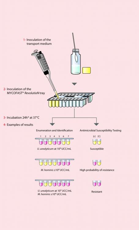 Mycofast® Revolution Elitechgroup In Vitro Diagnostic Equipment