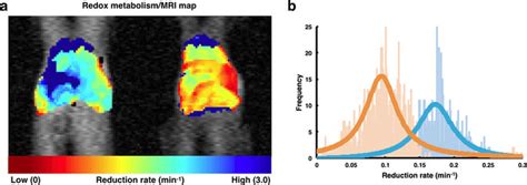 Mapping Of Redox Status Of Liver In Dimethylnitrosamine Dmn Treated