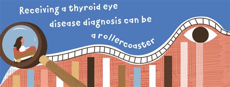 Thyroid Eye Disease In America Survey: Diagnosis, Management