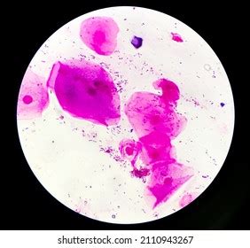 Sputum Gram Stain Microscopic View Show Stock Photo 2110943267 ...