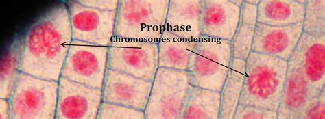 Interphase vs prophase - bingerscape