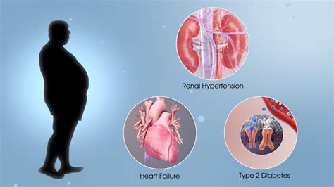 Metabolic Syndrome Type II Diabetes Functional Medicine Center