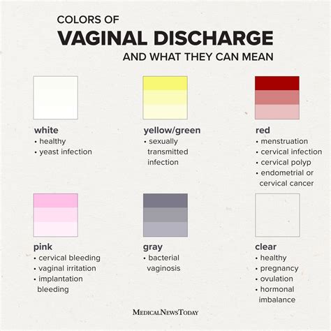 Bacterial Vaginosis Yellow Discharge