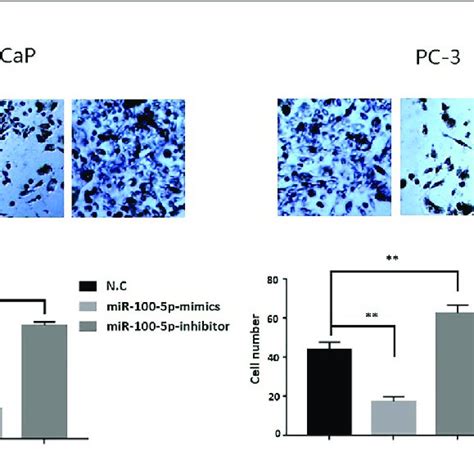 Invasion Ability Of Pca Cells After Transfection Lncap And Pc