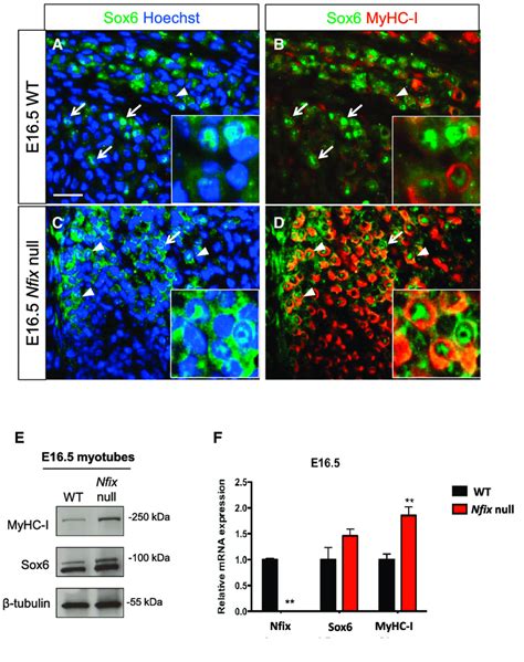 Nfix Is Necessary For The Correct Function Of Sox In Fetal Muscle