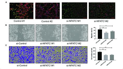 Nfatc Knockdown In H1975 Cells Promotes Progression Toward Complete