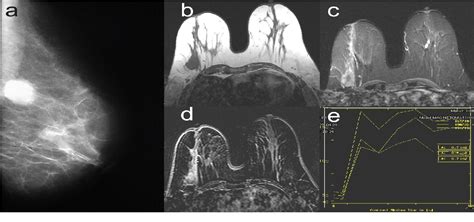 Figure 2 From Analysis Of Morphological Features And Contrast