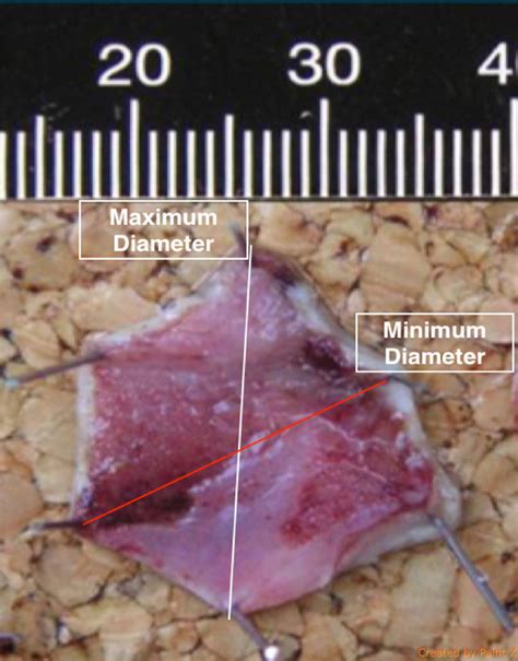 Emr Specimen Post Resection Pinned Down On Cork Board Showing The