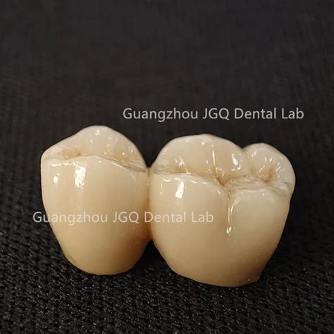 Customized CAD Cam Zirconia Fixed Dentures From China Dental Lab