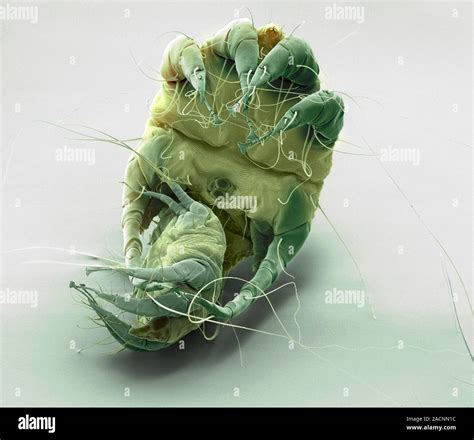 Mange mites. Coloured scanning electron micrograph (SEM) of two mites ...