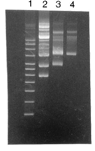 Plasmid Analysis Of L Lactis Strains Lanes 1 Supercoiled Dna Ladder Download Scientific