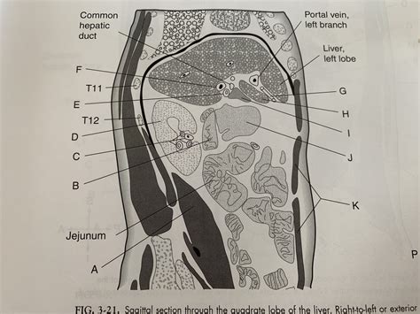 Fig Sagittal Section Through The Quadrate Lobe Of The Liver