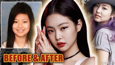 Blackpink Jennie Kim Plastic Surgery 2016 2020 Lifting The Veil