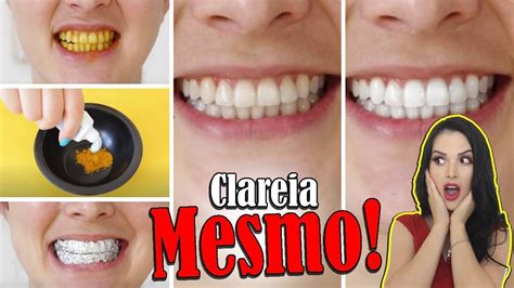 Maneiras De Clarear Os Dentes Em Casa Naturalmente Em Minutos