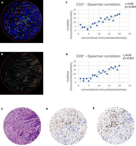 Frontiers Spatial Distribution Of Cd3 And Cd8 Positive Lymphocytes As Pretest For Pole Wild