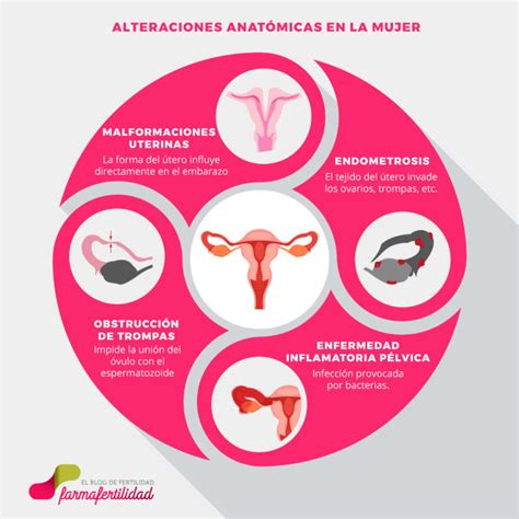 Alteraciones De La Anatom A Que Afectan A La Fertilidad Farma Fertilidad