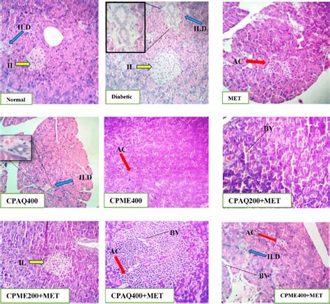 Histopathology Of The Pancreas Normal Pancreas Of The Normal Animal