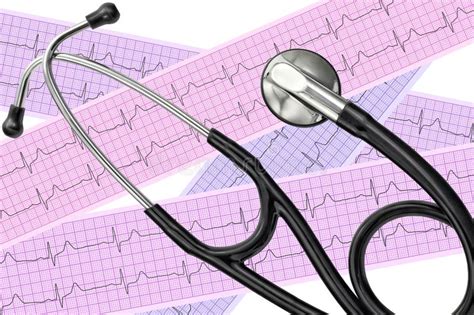 An Lisis Del Coraz N Gr Fico Del Electrocardiograma Ecg Y