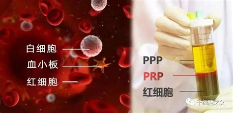 Prp卵巢回春术：神奇的prp助48岁患者恢复生育能力 干细胞and免疫细胞and外泌体and再生医学领域垂直媒体细胞世界