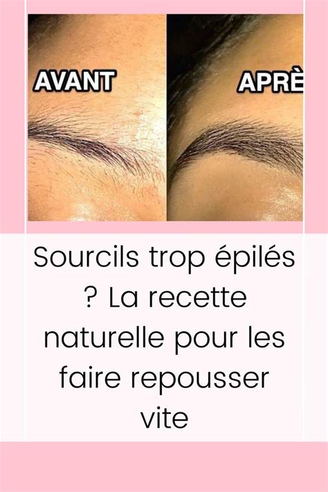 Sourcils Trop Pil S La Recette Naturelle Pour Les Faire Repousser