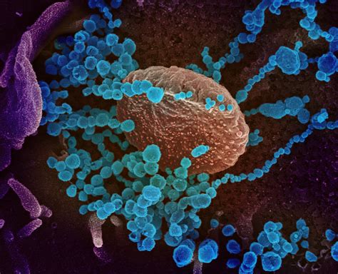 Der Oder Das Virus 4
