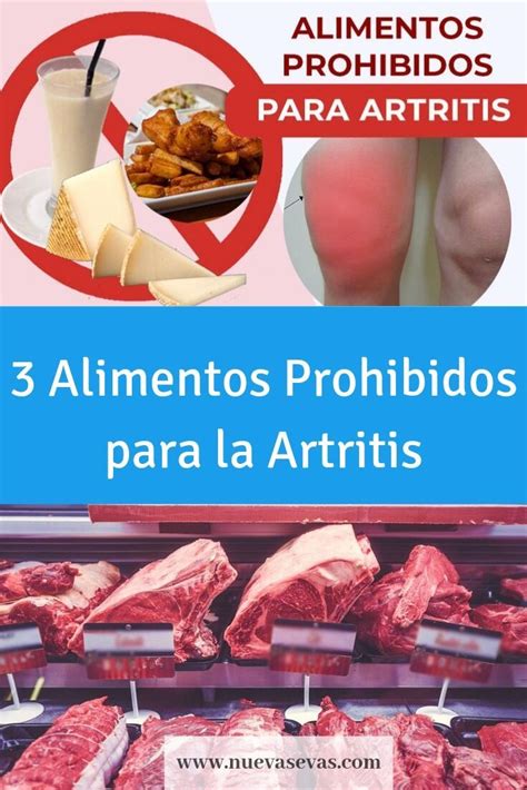 3 Alimentos Prohibidos Para La Artritis Que Aumentan El Dolor En Las Articulaciones Nuevas Evas