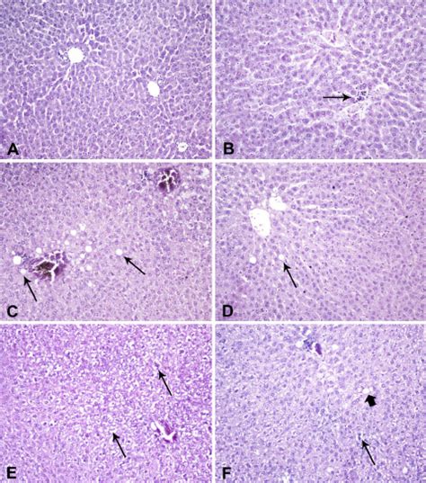 Representative Liver Figures Eosin Hematoxylin Staining 200 × Download Scientific Diagram