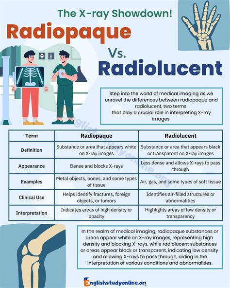 Radiopaque vs. Radiolucent: Demystifying the Terminology - English ...