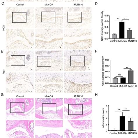 Inhibition Of MAGL Promotes The Polarization Of Macrophages Towards An