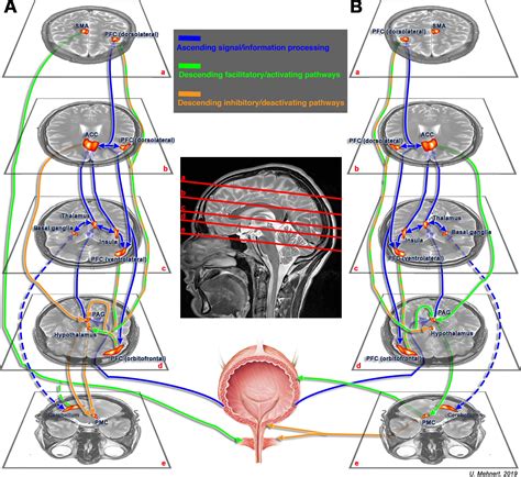 Neuroimaging In Neuro Urology European Urology Focus