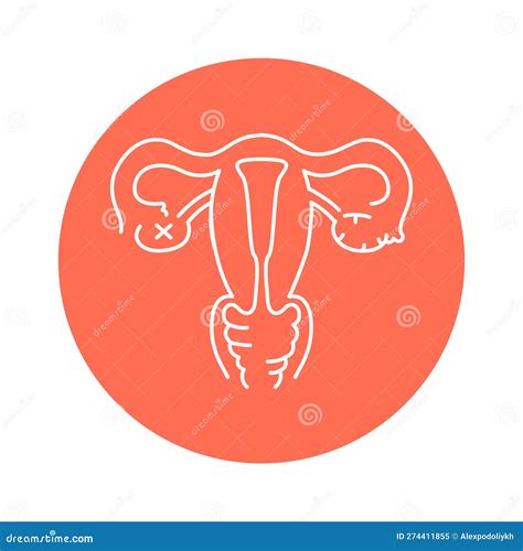 Uterine Myoma Color Line Icon Gynecology Problem Stock Vector