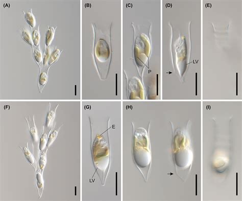 Frontiers Multigene Phylogeny Reveals A Cryptic Diversity In The