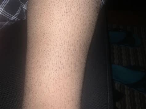 My leg hair is super dark and thick what setting do y’all recommend