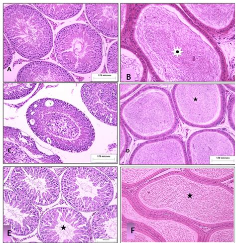 A Control Rat Testis Showing Multiple Cross Sections In Seminiferous