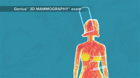 Genius 3d Mammography By Hologics Now Available At Harrington