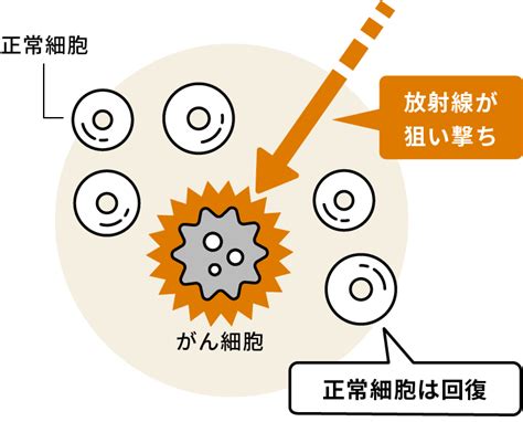 放射線治療とは｜放射線治療・ハイパーサーミアセンター｜がん診療について｜外来・入院｜原三信病院