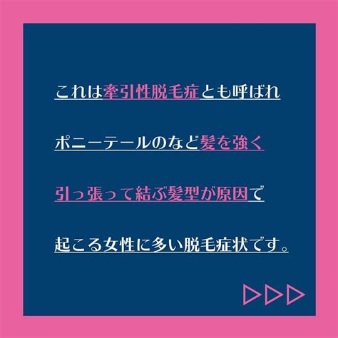 【公式】agaスキンクリニックさんのインスタグラム写真 【公式】agaスキンクリニックinstagram「『エクステは抜け毛の原因になる？』 髪の長さや量を変えられて便利なエクステ