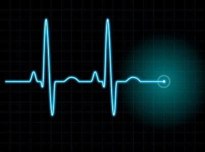 Is there any heartbeat like function? - MathOverflow