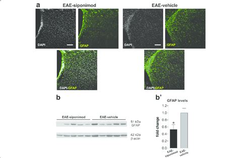 CNS Directed Delivery Of Siponimod Reduces Astrogliosis In The EAE