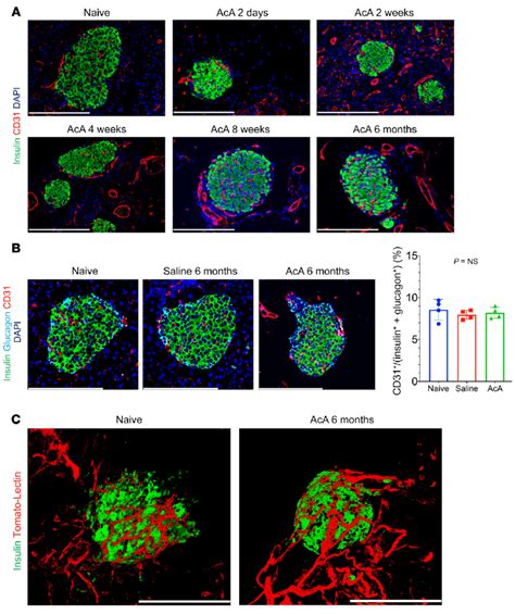 Chemical Pancreatectomy Preserves The Integrity Of Islet Vasculature