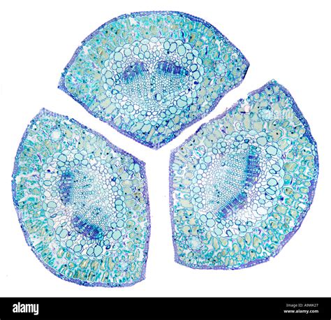 Pine leaf section photomicrograph Stock Photo - Alamy