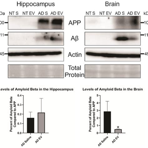 Levels Of Amyloid Beta Are Significantly Decreased In The Brain Of