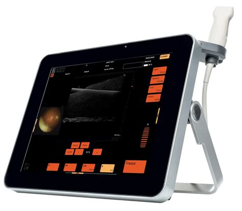 7starscope Echogeleide Percutane Micro Endoscopie Duomed