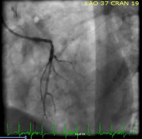 Dr. Smith's ECG Blog: May 2018