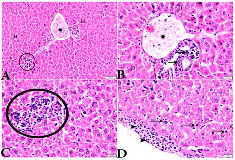 Photomicrograph Of Hande Stained Liver Tissue Sections From Toxoplasma