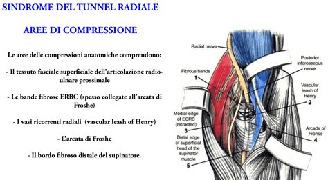 La Sindrome Del Tunnel Radiale E Del Nervo Interosseo Posteriore Nip