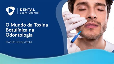 O Mundo Da Toxina Botulínica Na Odontologia Youtube