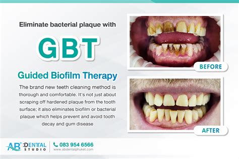 Biofilm Logo