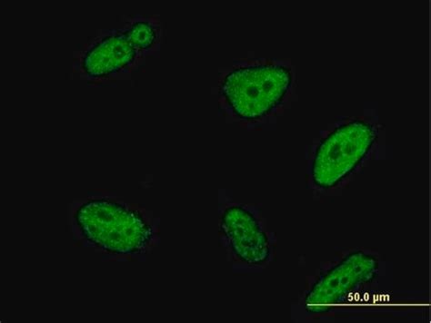 Monoclonal Anti Polr C Antibody Produced In Mouse Clone A H