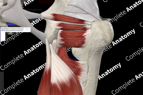 Quadratus Femoris Mri Of Quadratus Femoris Muscle Tear Another Cause